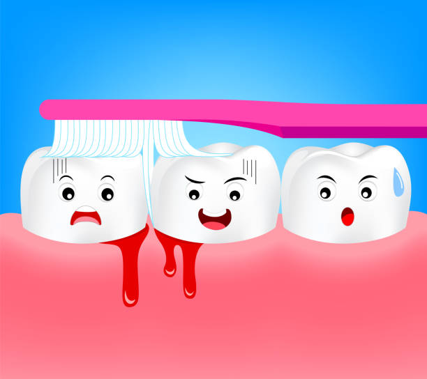 Bleeding gums